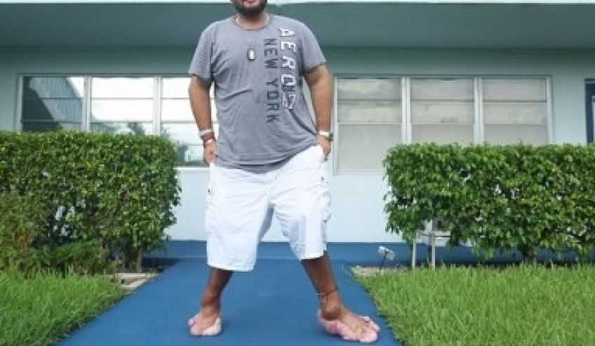 سندروم پروتئوس بیماری ناشناخته عجیب