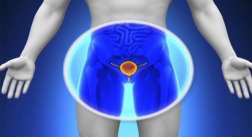 تشخیص سرطان پروستات و علائم آن