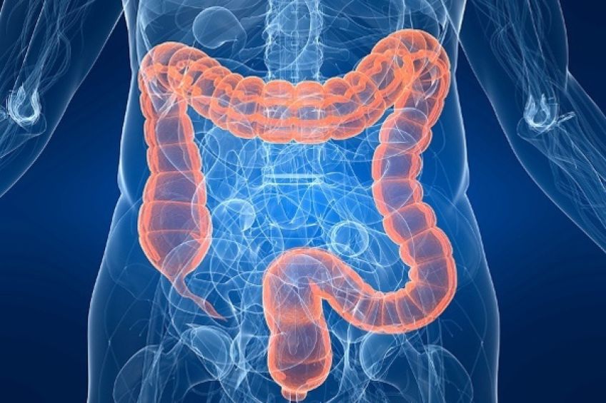با علائم  IBS یا سندروم روده تحریک پذیر آشنا شویم