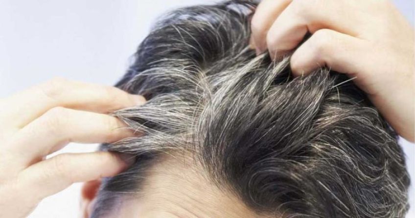 چند ماده غذایی برای پیشگیری از سفید شدن مو