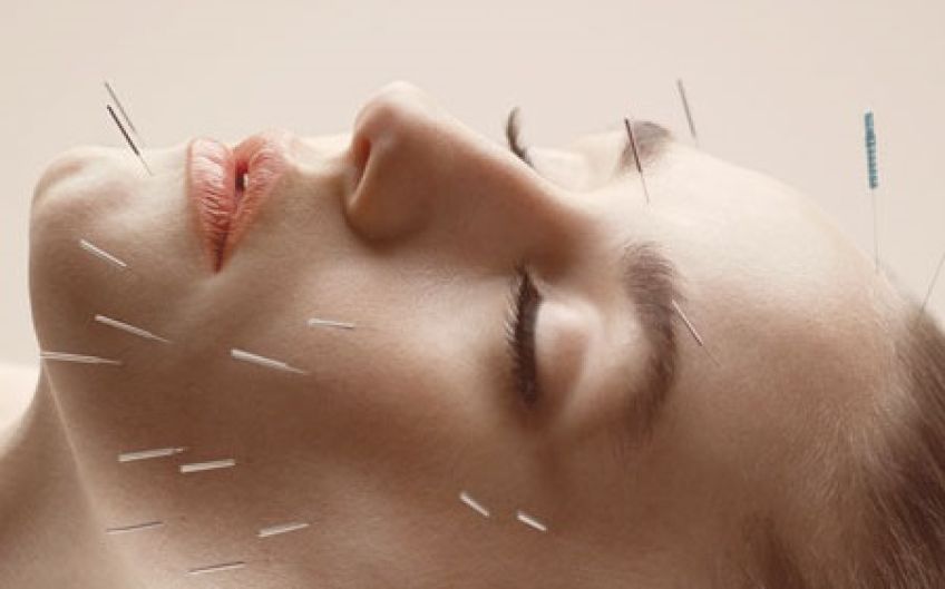 جوانسازی پوست با روش طب سوزنی