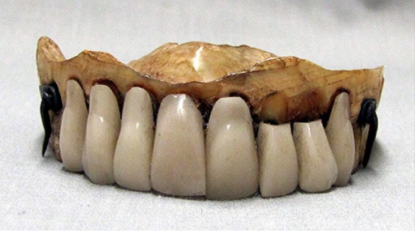 تاریخچه ساخت دندان مصنوعی