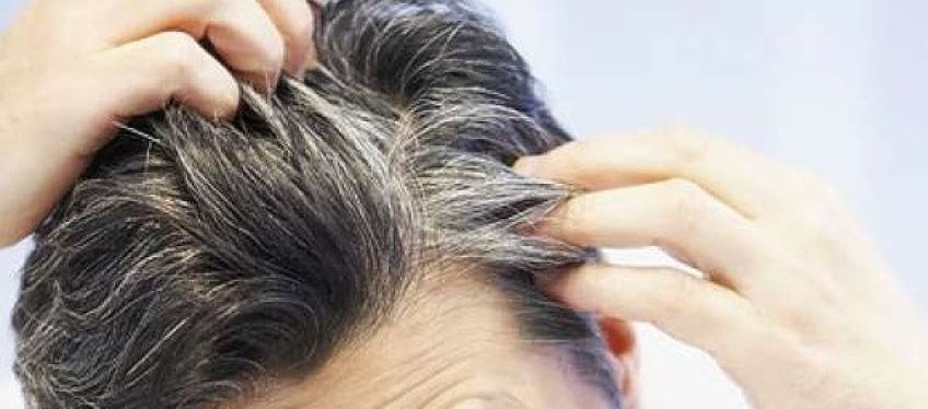 میوه هایی که از سفید شدن مو جلوگیری می کنند