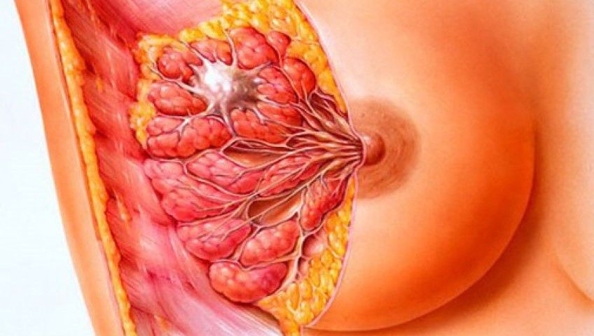 ماستیت و یا التهاب سینه مادران شیرده چگونه درمان می شود
