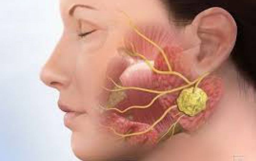 دلایل تومور فک و صورت و نحوه  تشخیص این بیماری