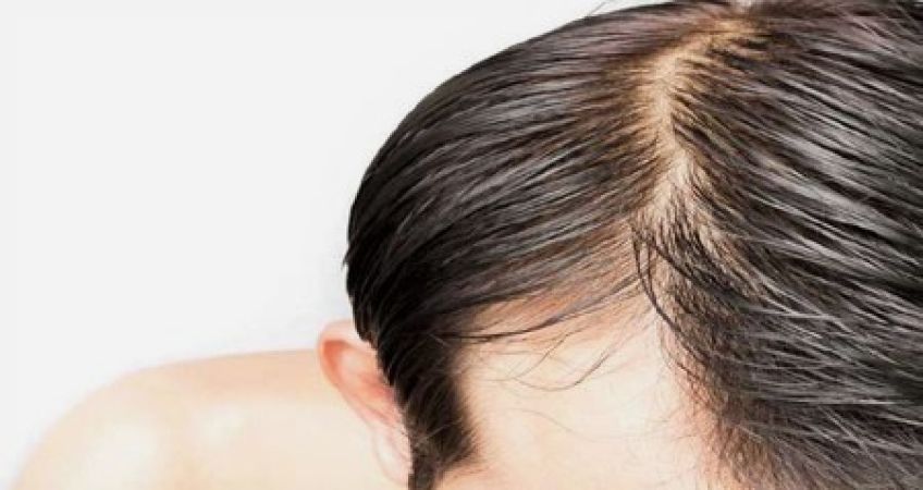 برای موهای چرب از چه شامپویی استفاده کنیم