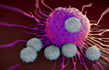 روش جلوگیری از پیشروی و گسترش سلول های سرطانی در بدن