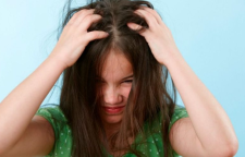 علت خارش پوست سر و راه های درمان آن