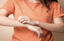 انواع خارش و آلرژی پوستی و راه های پیشگیری و درمان آن