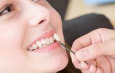 چگونه دندان های خود را زیباتر کنیم؟