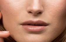 درمان خانگی منافذ باز پوست صورت