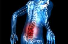 هر آنچه که در مورد کمردرد باید بدانیم