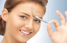 علت جوش زدن صورت و انواع آن