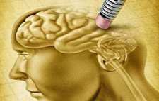 چه عواملی باعث می شوند به آلزایمر مبتلا شویم