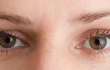 علت افتادگی پلک چشم و راه های درمان آن