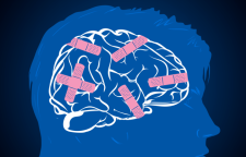 آسیب های ذهنی ناشی از بیماری افسردگی