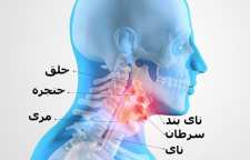 نشانه های سرطان حنجره و درمان آن