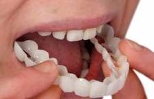 لامینت یا ونیر دندان چیست؟