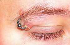 عوارض پیرسینگ