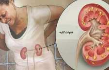 هرآنچه که در مورد عفونت کلیه باید بدانیم