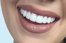 هر آنچه که در مورد کامپوزیت دندان  باید بدانید
