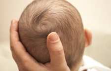 چگونه تشخیص بدهیم فرم سر نوزاد طبیعی است