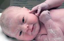 خواص ورنیکس یا ماده سفید رنگ روی بدن نوزاد در هنگام تولد چیست