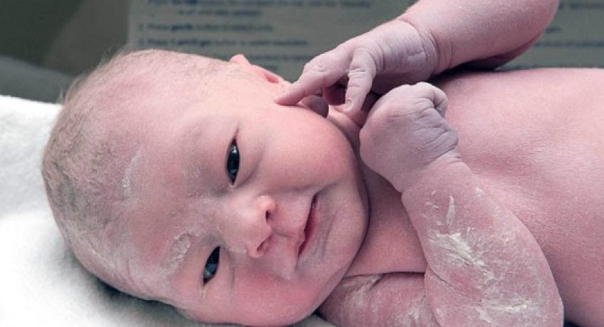 خواص ورنیکس یا ماده سفید رنگ روی بدن نوزاد در هنگام تولد چیست