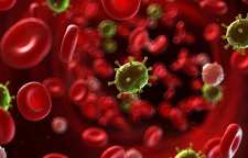 علائم لوسمی یا سرطان خون چیست