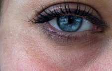 ماسک های خانگی برای درمان و از بین بردن سیاهی و کبودی دور چشم