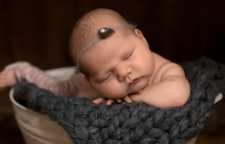 چرا موی بعضی نوزادان کم پشت است