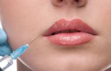 همه چیز درباره تزریق ژل لب یا تزریق فیلر لب