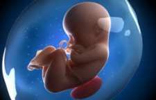 سکسکه جنین در شکم مادر ممکن است به علت پیچ خوردگی بند ناف باشد