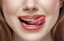 روش های ساده و مفید برای پیشگیری از خشک شدن لب ها