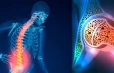 مواد غذایی که موجب استحکام استخوان می شود