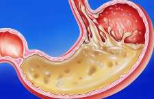 نحوه پاکسازی و مسهل کردن معده