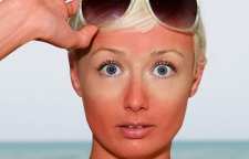 روش های مفید برای درمان خانگی آفتاب سوختگی