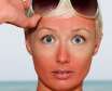 روش های مفید برای درمان خانگی آفتاب سوختگی