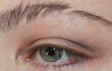 علت ریزش ابرو و روش درمان آن