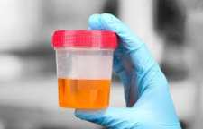 ادرار نارنجی رنگ نوزاد نشان دهنده چیست