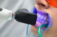 بلیچینگ با لیزر روشی برای سفید کردن دندان