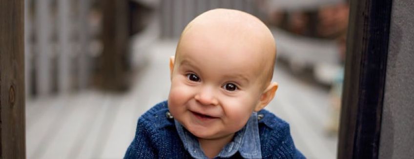 عوامل موثر بر ریزش موی نوزاد