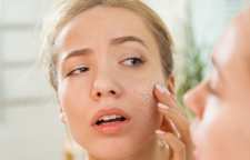 درست کردن کرم مخصوص پوست خشک در منزل