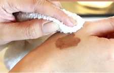 روش هایی برای پاک کردن لکه رنگ مو از روی پوست