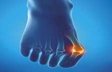 چرا بعضی انگشتان کج می شوند