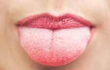 علائم سوزش دهان و زبان به همراه درمان آن