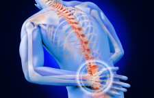 دیسک کمر و کمر درد چگونه ایجاد می شوند و راه های درمان آن