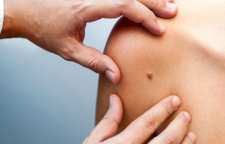 پیشگیری از ابتلا به زگیل و راه های درمان طبیعی آن