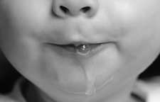 دلایل زیادی آب دهان و یا بزاق چیست