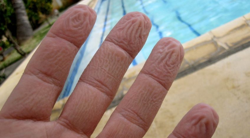 چرا پوست دست در آب چروک می شود